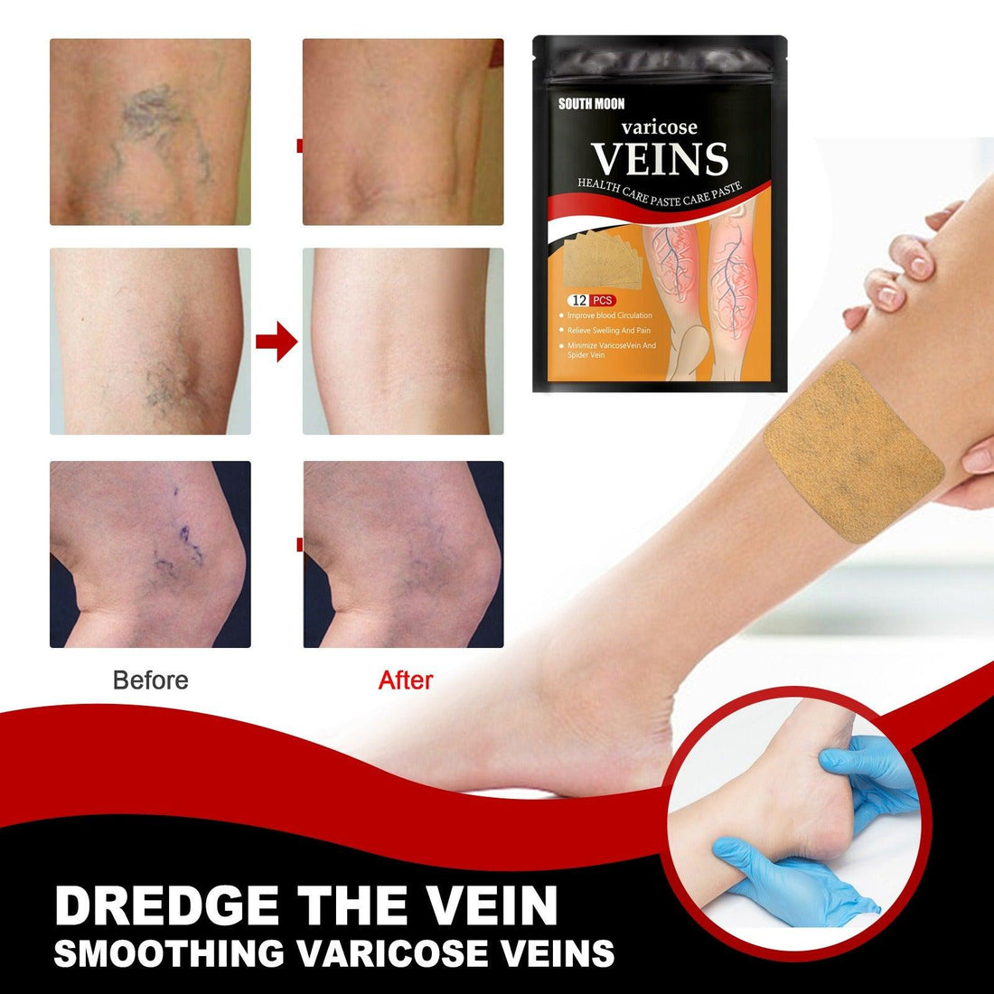 Instant Varicose Veins Relieve Patch - Calmady