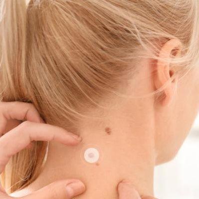 Skin Tag Remover Patch - Calmady